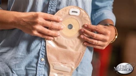 Common Ostomy Issues: Why Does My Ostomy Bag Keep。